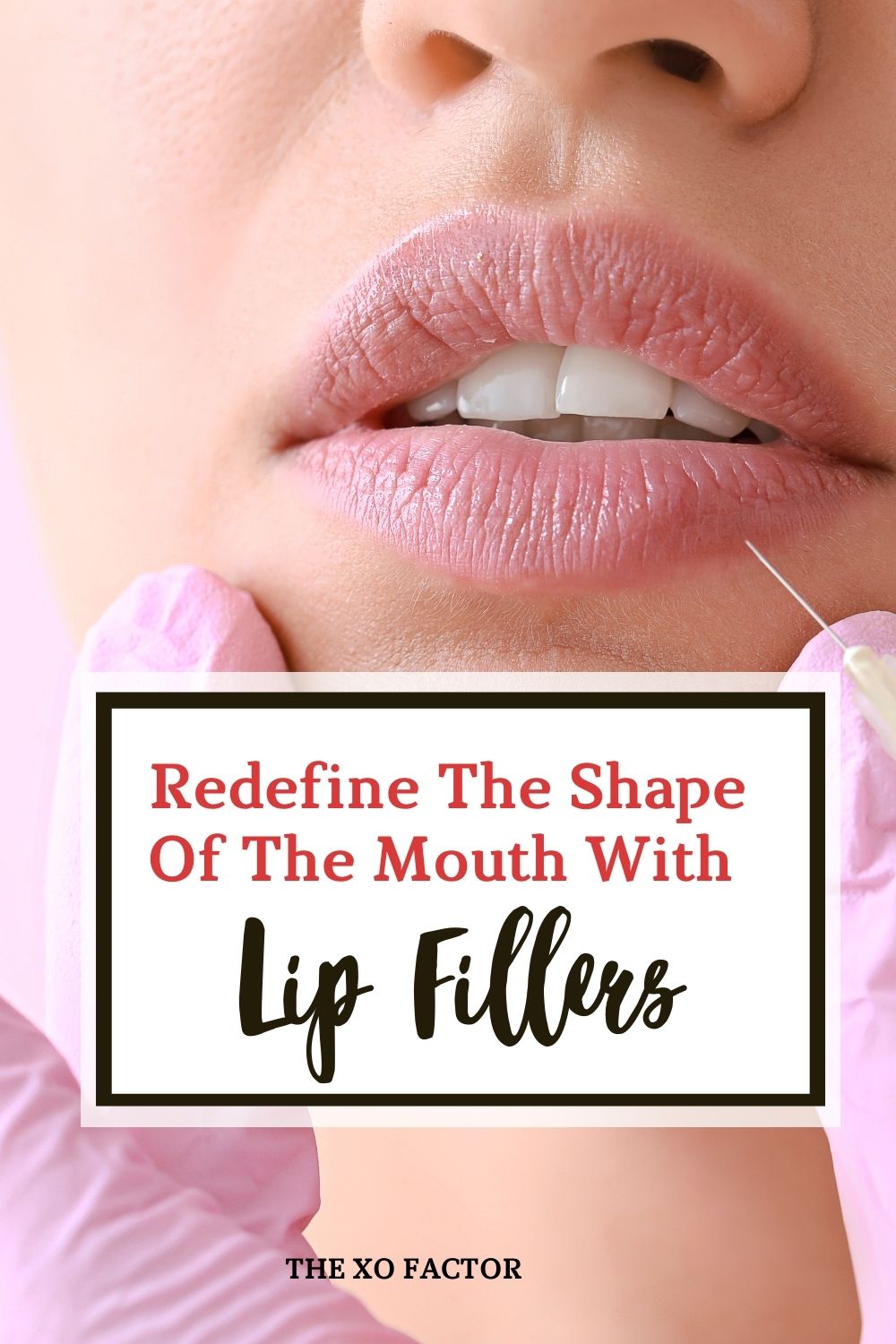 Redefine The Shape Of The Mouth With Lip Fillers