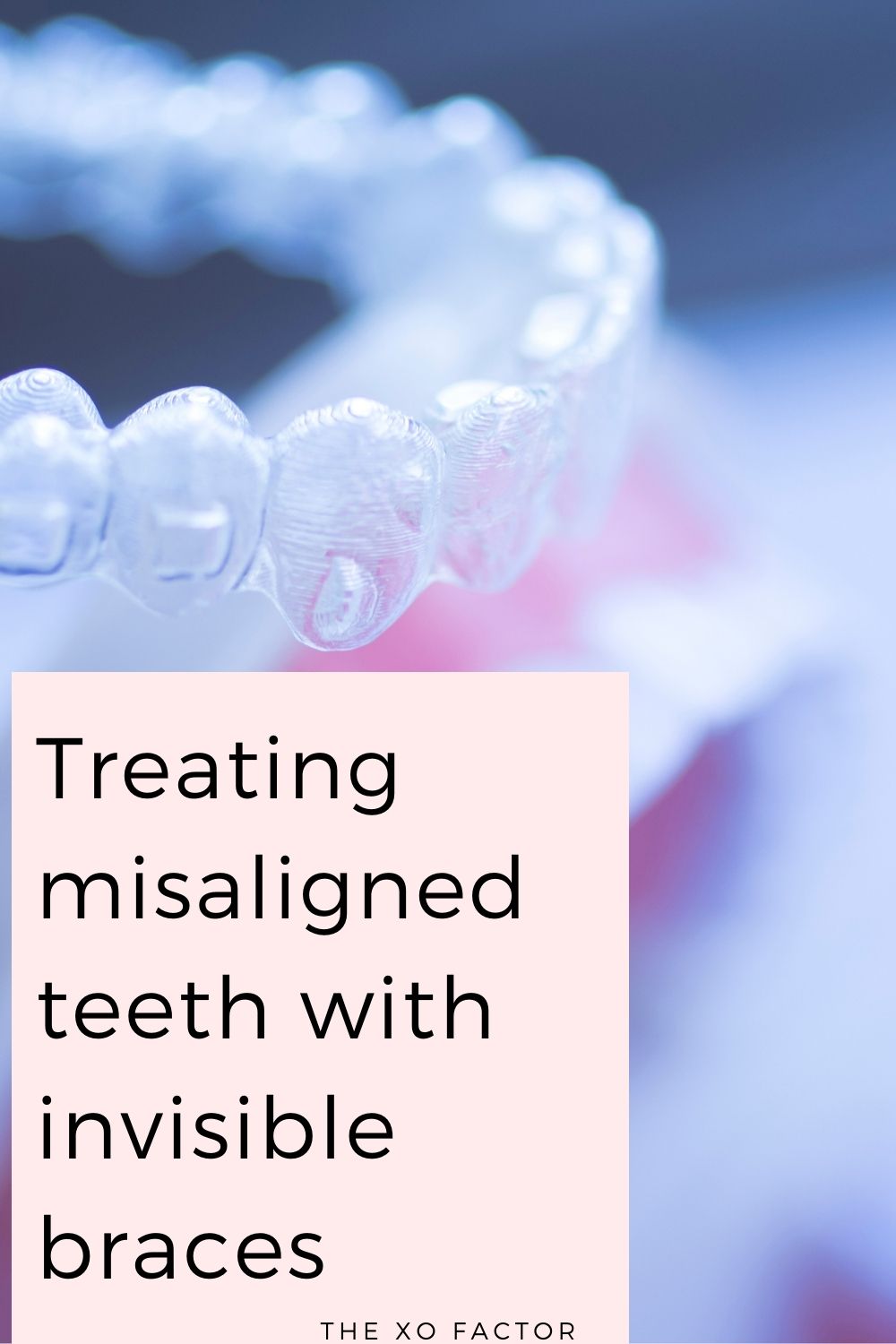 Treating misaligned teeth with invisible braces