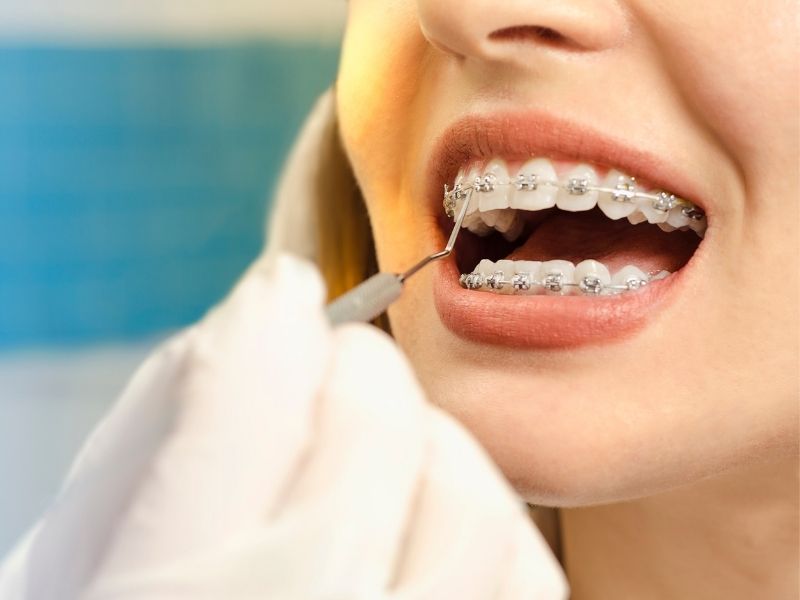 Your Smile In Our Hands, Braces Stoke-On-Trent