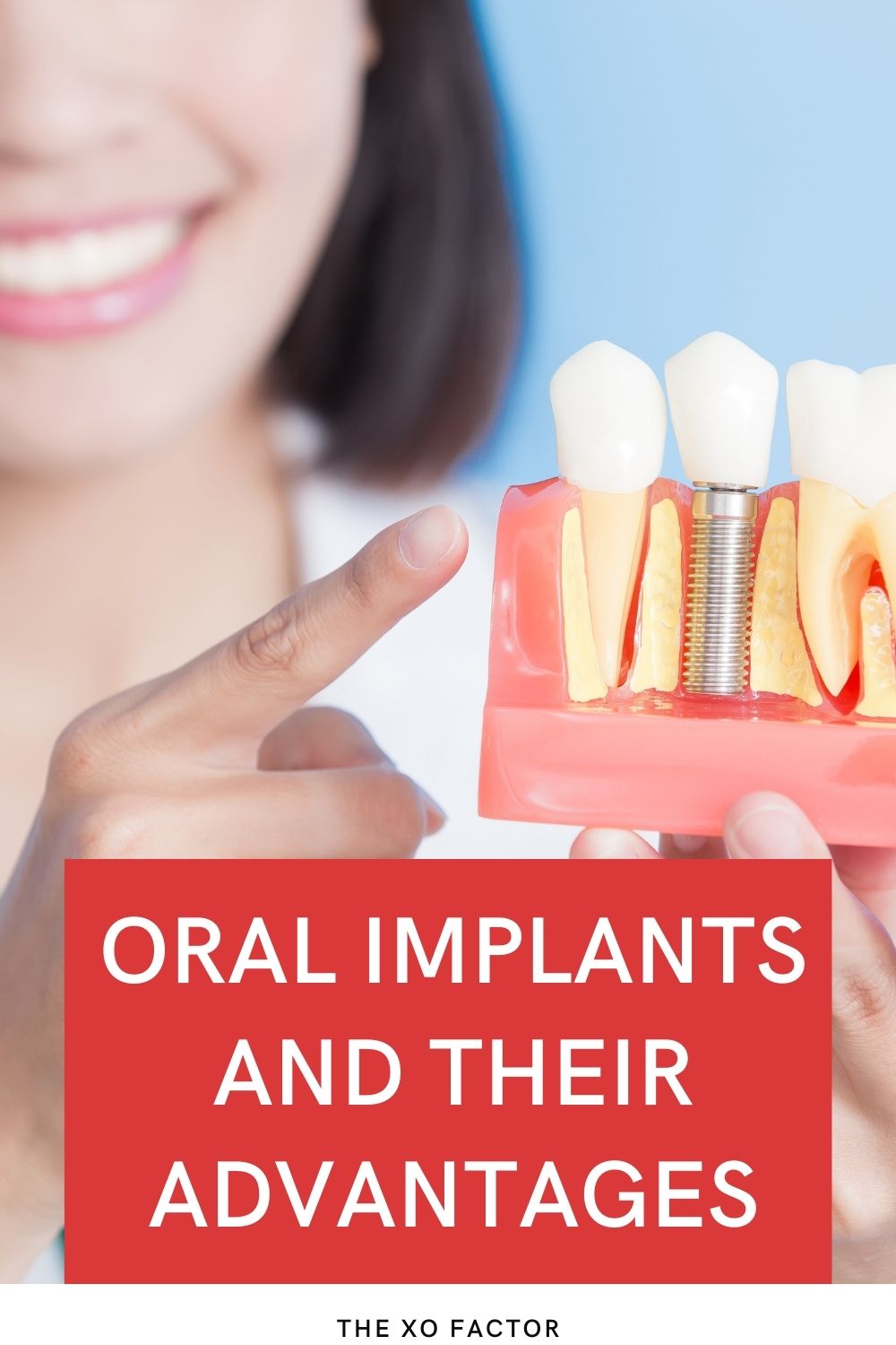 Oral Implants And Their Advantages