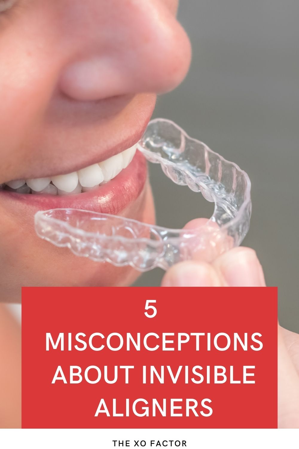 5 Misconceptions About Invisible Aligners
