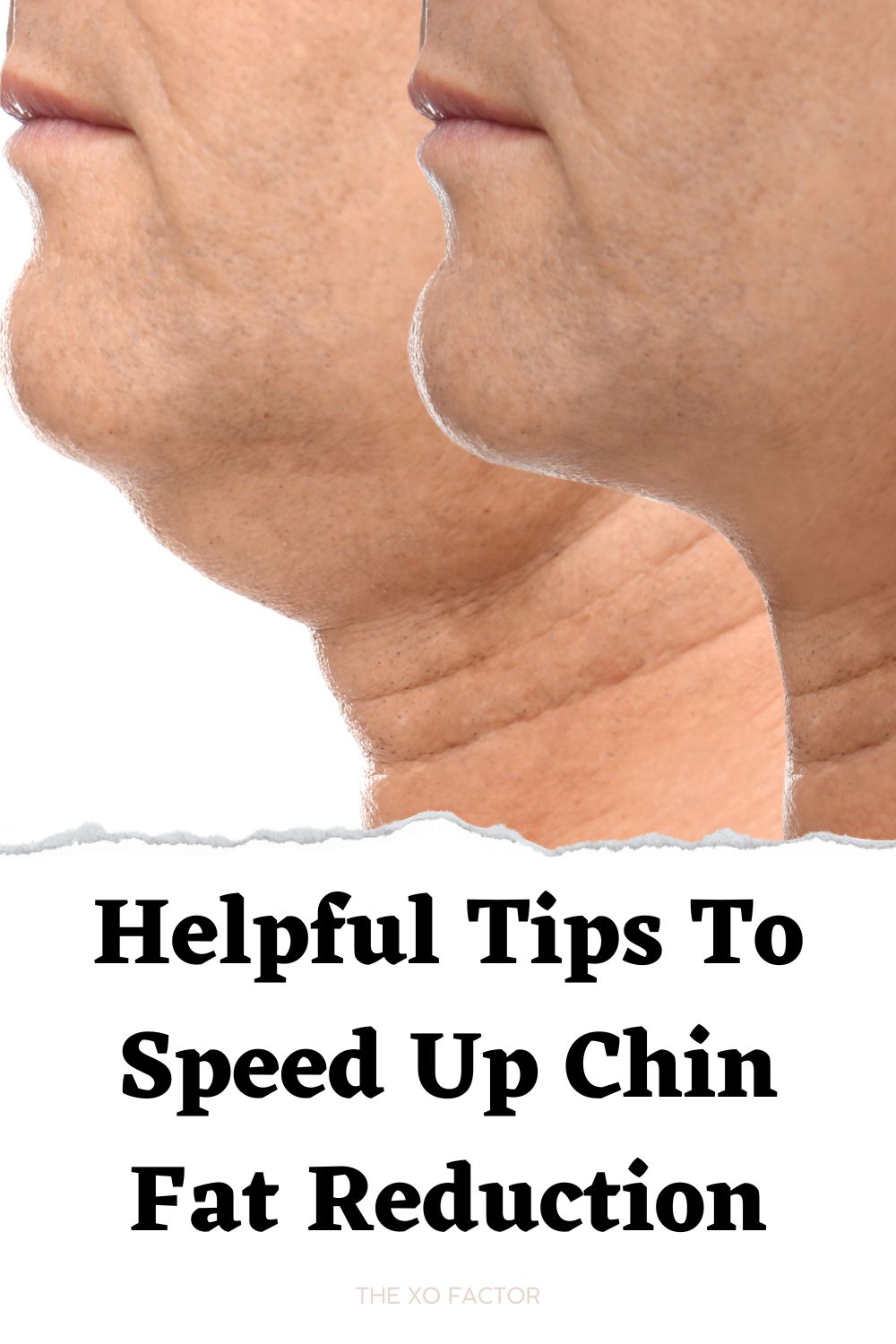 Helpful Tips To Speed Up Chin Fat Reduction