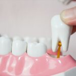 The Effects Of Tooth Loss And How They Can Be Prevented With Implants