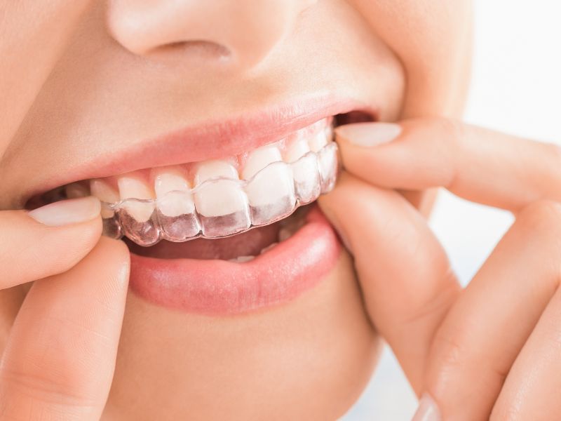 Why do orthodontists recommend orthodontics?