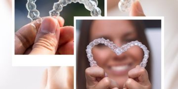 The Art Of Straighter Teeth With Invisalign Dublin