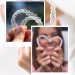 The Art Of Straighter Teeth With Invisalign Dublin