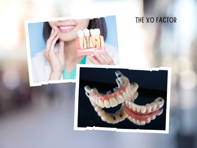 Oral Implants: Who Can And Cannot Have Them?