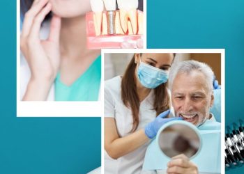 Oral Implants: Who Can And Cannot Have Them?